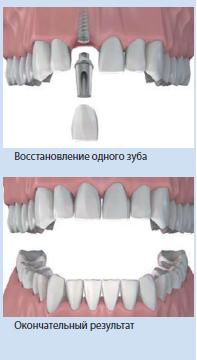 �������������� ����